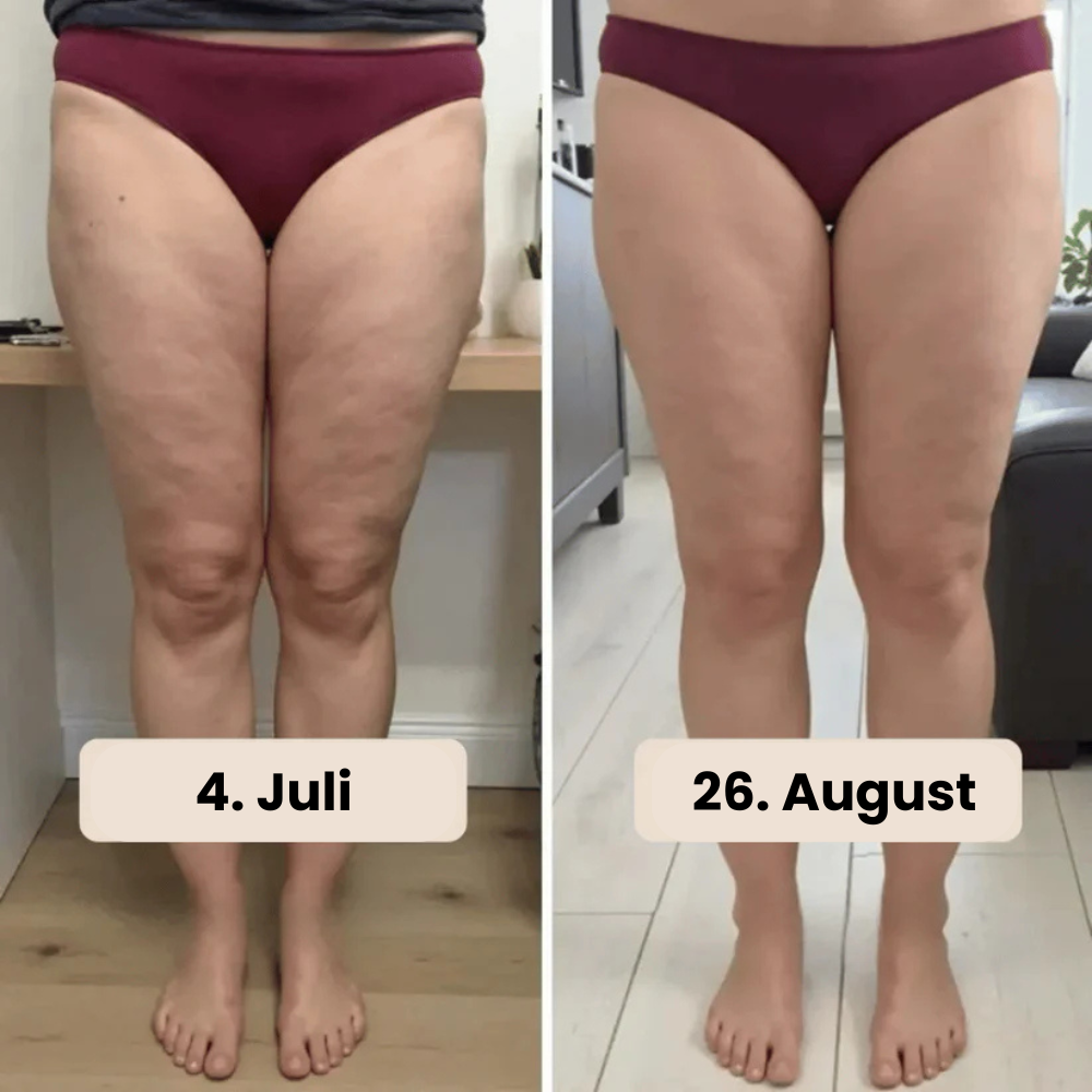 3D Anti-Cellulite Leggings